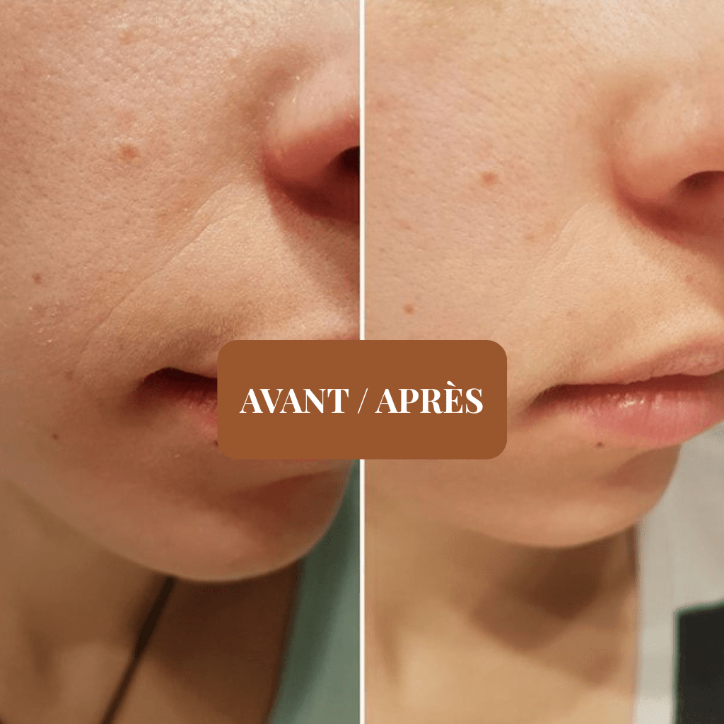 Soins naturels peau sèche - Rituel Dela - Dado Cosmetics